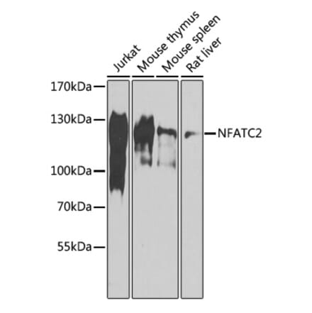 Western Blot - Anti-NFAT1 Antibody (A88150) - Antibodies.com