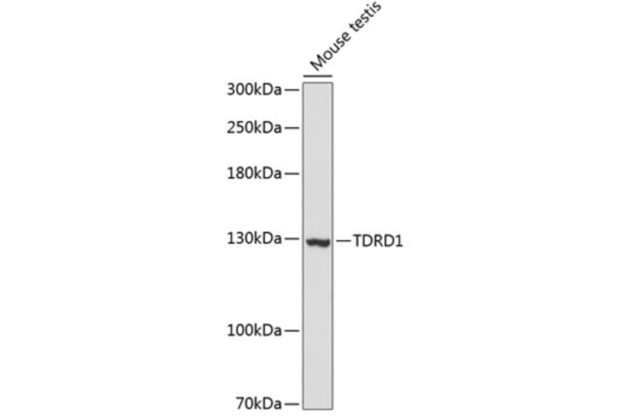 Western Blot - Anti-TDRD1 Antibody (A88153) - Antibodies.com