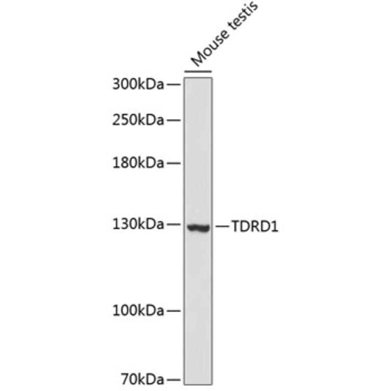 Western Blot - Anti-TDRD1 Antibody (A88153) - Antibodies.com