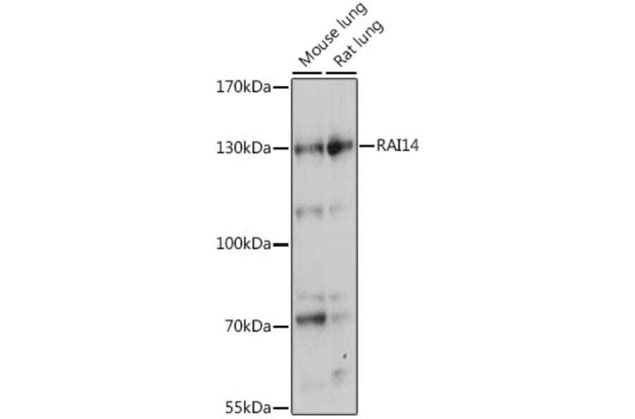 Western Blot - Anti-RAI14 Antibody (A88154) - Antibodies.com