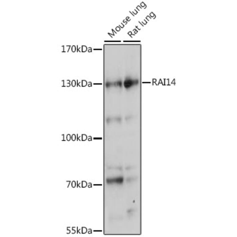 Western Blot - Anti-RAI14 Antibody (A88154) - Antibodies.com