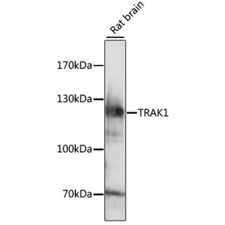 Western Blot - Anti-TRAK1 Antibody (A15249) - Antibodies.com