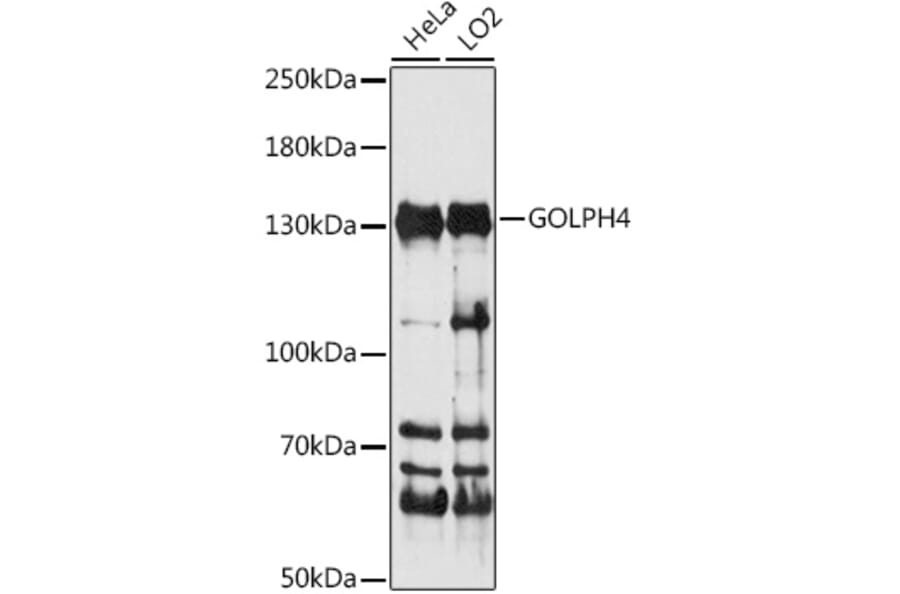 Western Blot - Anti-GOLPH4/GPP130 Antibody (A88156) - Antibodies.com