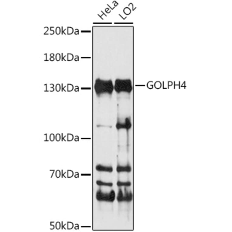 Western Blot - Anti-GOLPH4/GPP130 Antibody (A88156) - Antibodies.com