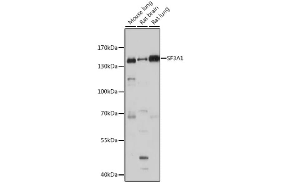 Western Blot - Anti-SF3A1 Antibody (A88157) - Antibodies.com
