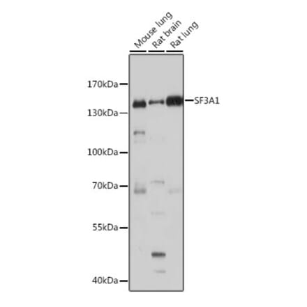 Western Blot - Anti-SF3A1 Antibody (A88157) - Antibodies.com