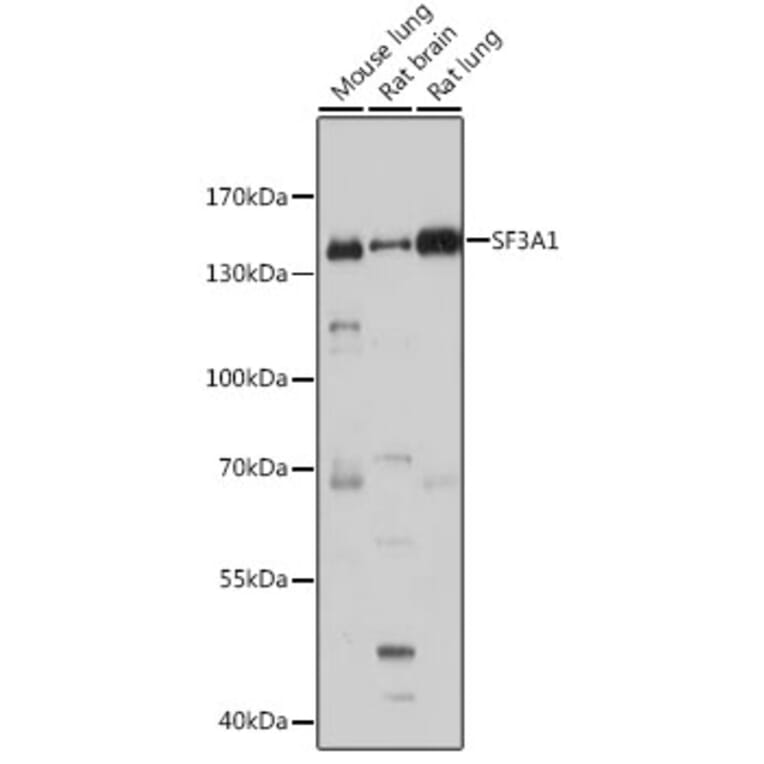 Western Blot - Anti-SF3A1 Antibody (A88157) - Antibodies.com