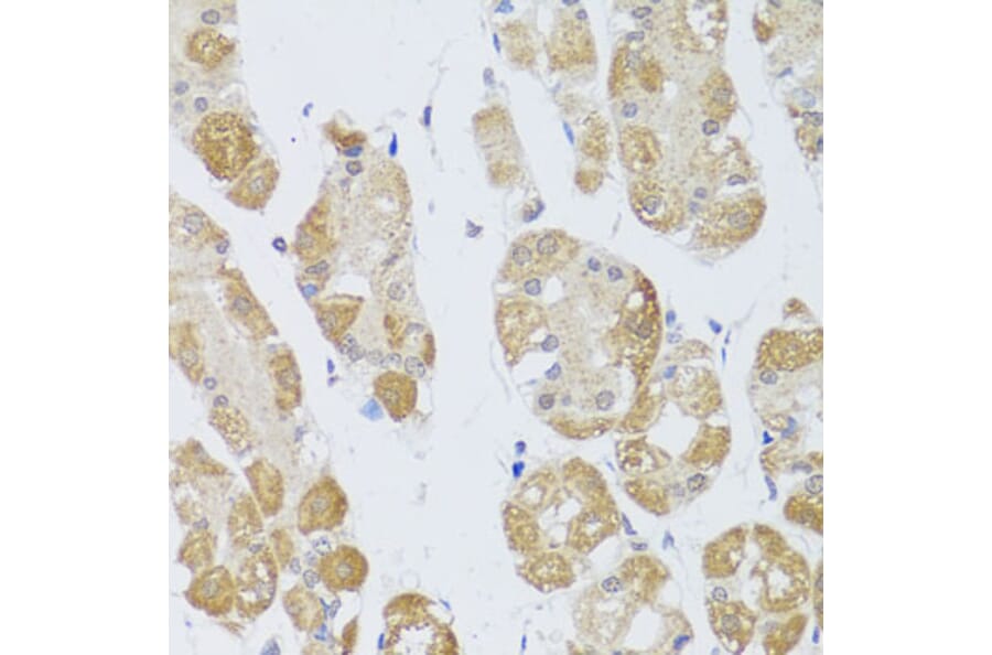 Immunohistochemistry - Anti-HDAC4 Antibody (A88158) - Antibodies.com