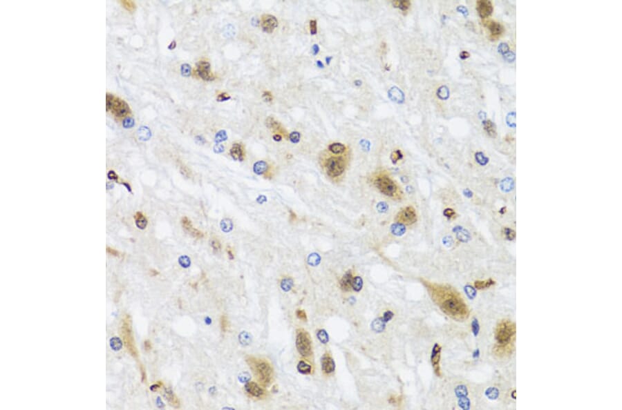 Immunohistochemistry - Anti-HDAC4 Antibody (A88158) - Antibodies.com
