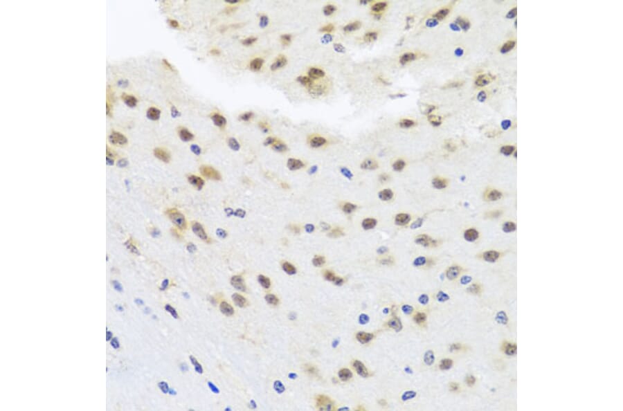 Immunohistochemistry - Anti-HDAC4 Antibody (A88158) - Antibodies.com