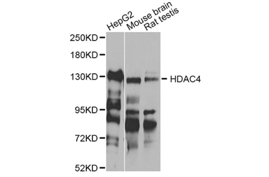Western Blot - Anti-HDAC4 Antibody (A12552) - Antibodies.com