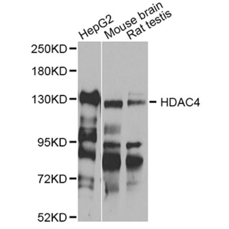 Western Blot - Anti-HDAC4 Antibody (A12552) - Antibodies.com