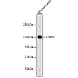 Western Blot - Anti-ENPP2 Antibody (A16021) - Antibodies.com