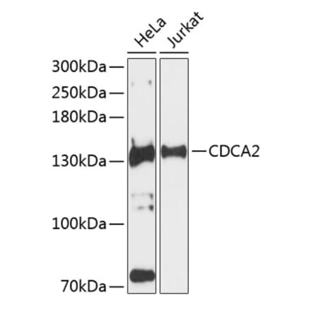 Western Blot - Anti-CDCA2 Antibody (A88161) - Antibodies.com