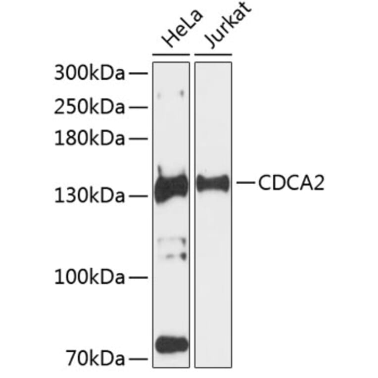 Western Blot - Anti-CDCA2 Antibody (A88161) - Antibodies.com