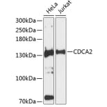 Western Blot - Anti-CDCA2 Antibody (A88161) - Antibodies.com