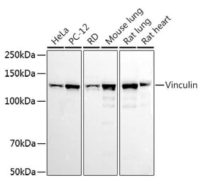Western Blot - Anti-Vinculin Antibody (A88162) - Antibodies.com