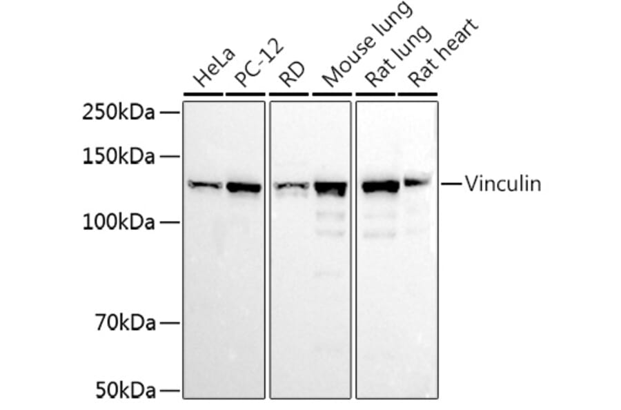 Western Blot - Anti-Vinculin Antibody (A88162) - Antibodies.com