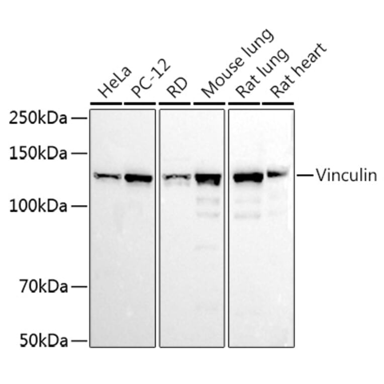 Western Blot - Anti-Vinculin Antibody (A88162) - Antibodies.com