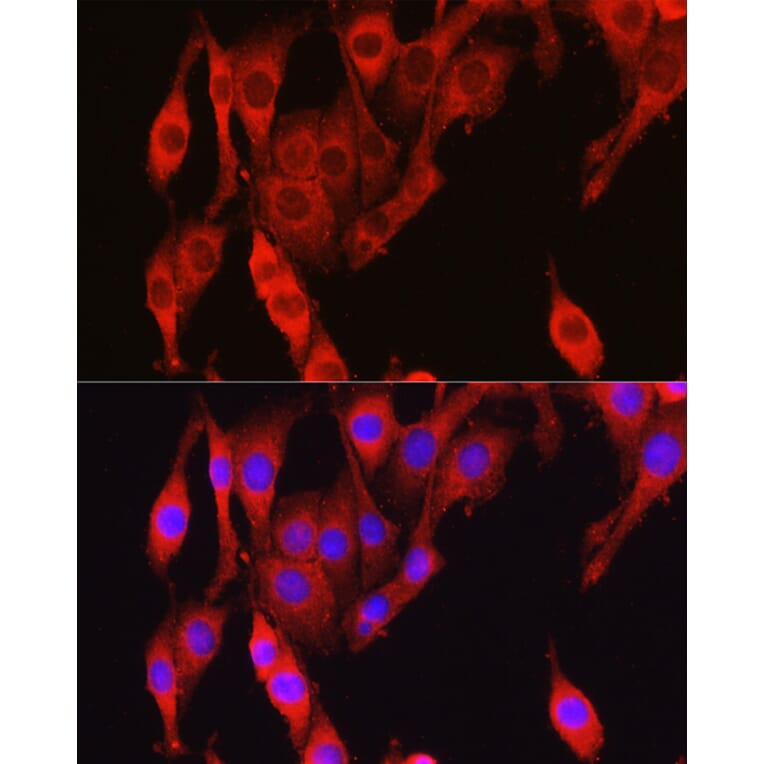 Immunofluorescence - Anti-Vinculin Antibody (A88162) - Antibodies.com