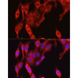 Immunofluorescence - Anti-Vinculin Antibody (A88162) - Antibodies.com