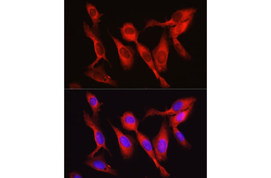 Immunofluorescence - Anti-Vinculin Antibody (A88162) - Antibodies.com