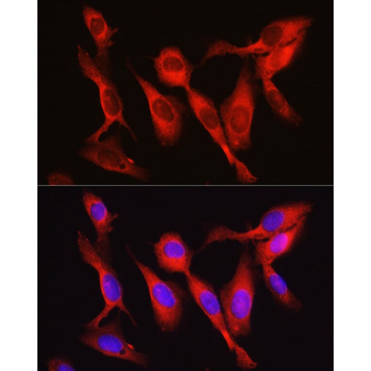 Immunofluorescence - Anti-Vinculin Antibody (A88162) - Antibodies.com