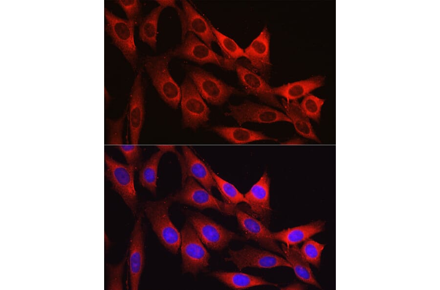 Immunofluorescence - Anti-Vinculin Antibody (A88162) - Antibodies.com