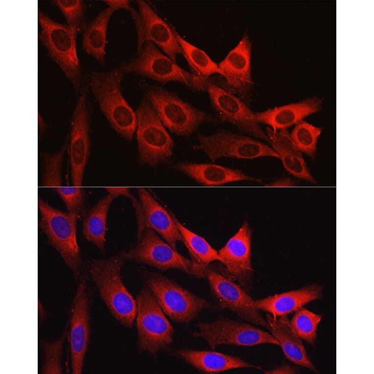 Immunofluorescence - Anti-Vinculin Antibody (A88162) - Antibodies.com