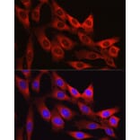Immunofluorescence - Anti-Vinculin Antibody (A88162) - Antibodies.com