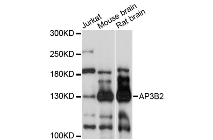 Western Blot - Anti-AP3B2 Antibody (A13808) - Antibodies.com