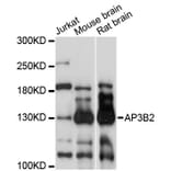 Western Blot - Anti-AP3B2 Antibody (A13808) - Antibodies.com