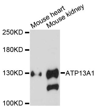 Western blot analysis of extracts of various cell lines, using Anti-ATP13A1 Antibody (A13900) at 1:3000 dilution.
Secondary antibody: Goat Anti-Rabbit IgG (H+L) (HRP) (AS014) at 1:10,000 dilution.
Lysates / proteins: 25µg per lane.
Blocking buffer: 3% non-fat dry milk in TBST.
Detection: ECL Enhanced Kit (RM00021).
Exposure time: 90s.