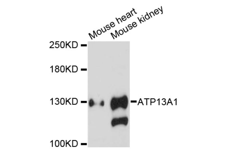 Western Blot - Anti-ATP13A1 Antibody (A13900) - Antibodies.com