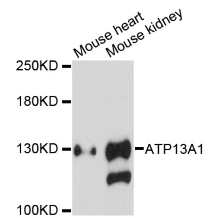 Western Blot - Anti-ATP13A1 Antibody (A13900) - Antibodies.com