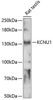 Western blot analysis of extracts of rat testis, using Anti-KCNU1 Antibody (A14967) at 1:1,000 dilution.
Secondary antibody: Goat Anti-Rabbit IgG (H+L) (HRP) (AS014) at 1:10,000 dilution.
Lysates / proteins: 25µg per lane.
Blocking buffer: 3% non-fat dry milk in TBST.
Detection: ECL Basic Kit (RM00020).
Exposure time: 90s.
