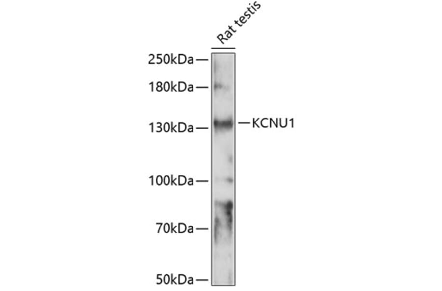 Western Blot - Anti-KCNU1 Antibody (A88165) - Antibodies.com