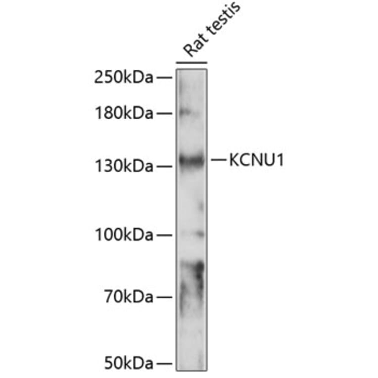 Western Blot - Anti-KCNU1 Antibody (A88165) - Antibodies.com