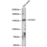 Western Blot - Anti-KCNU1 Antibody (A88165) - Antibodies.com