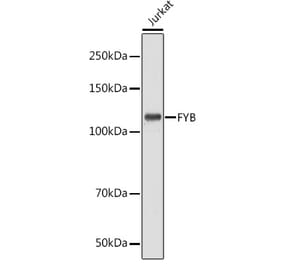 Western Blot - Anti-FYB Antibody (A88166) - Antibodies.com