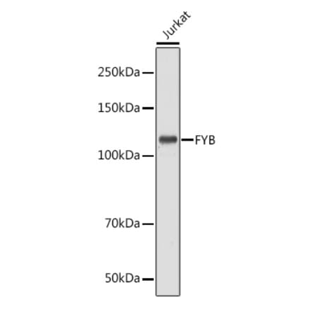 Western Blot - Anti-FYB Antibody (A88166) - Antibodies.com