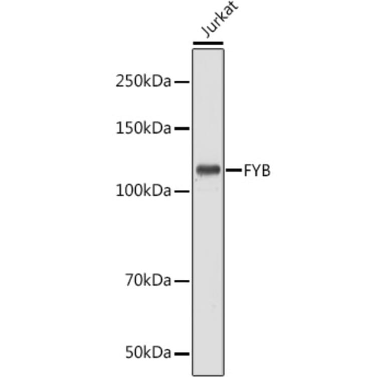 Western Blot - Anti-FYB Antibody (A88166) - Antibodies.com