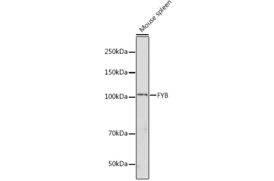 Western Blot - Anti-FYB Antibody (A88166) - Antibodies.com