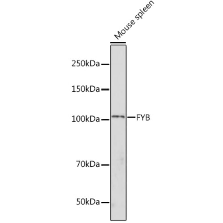 Western Blot - Anti-FYB Antibody (A88166) - Antibodies.com