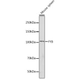 Western Blot - Anti-FYB Antibody (A88166) - Antibodies.com