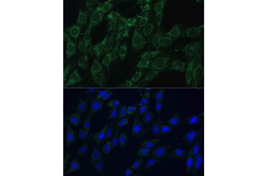 Immunofluorescence - Anti-AEBP1 Antibody (A88167) - Antibodies.com