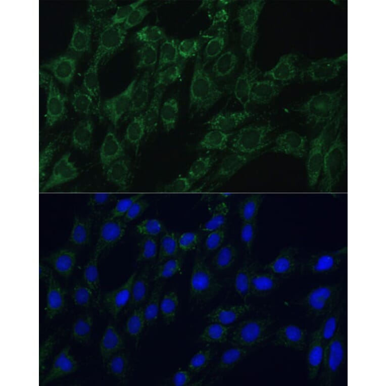 Immunofluorescence - Anti-AEBP1 Antibody (A88167) - Antibodies.com