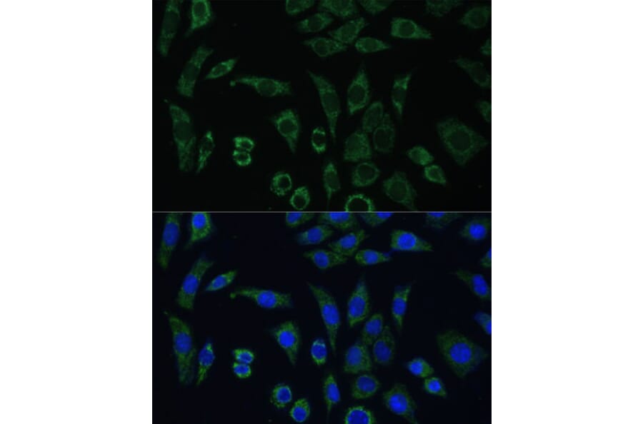 Immunofluorescence - Anti-AEBP1 Antibody (A88167) - Antibodies.com