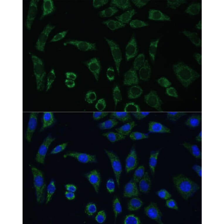 Immunofluorescence - Anti-AEBP1 Antibody (A88167) - Antibodies.com