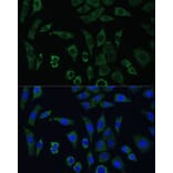 Immunofluorescence - Anti-AEBP1 Antibody (A88167) - Antibodies.com